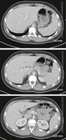 Abdominal Scans: Axial CT Images