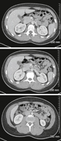 Abdominal Scans: Axial CT Images (continued)