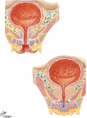 Urinary Bladder: Female and Male