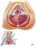 Female Perineum (Deeper Dissection)