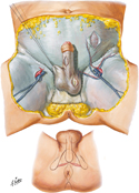 Male Perineum and External Genitalia (Superficial Dissection)