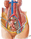 Lymphatic Vessels and Lymph Nodes of Pelvis and Genitalia: Female