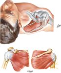 Rotator Cuff Muscles