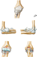 Ligaments of Elbow