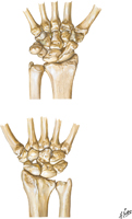 Carpal Bones