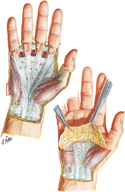 Wrist and Hand: Superficial Palmar Dissections