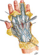 Wrist and Hand: Superficial Dorsal Dissection