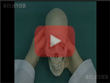  Osteology of the Head and Neck: Step 4.  Introduction to the skull