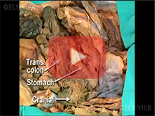  Celiac Trunk, Superior Mesenteric Vessels and Related Viscera: Step 6, Primary and secondary branch
