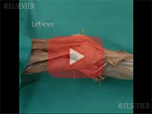  Knee: Step 4, Medial (Tibial) collateral ligament