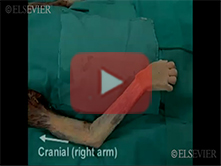  Flexor and Extensor Compartment of the Arm and Shoulder Joint: Step 1, Olecranon bursa, brachial fa