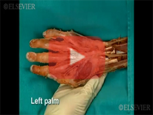  Palm: Step 6, Common flexor synovial sheath, ulnar bursa