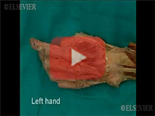  Extensor Surface of the Forearm and Dorsum of the Hand: Step 8, Nail bed, distal interphalangeal (D
