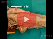  Medial and Anterior Thigh: Step 4, Sartorius muscle; medial and lateral intermuscular septa