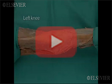  Knee: Step 5, Patella, patellar ligament and patellar retinaculum