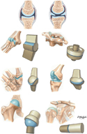Types of Synovial Joints