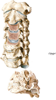 Cervical Vertebrae: Degenerative Changes