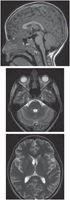 Head: MRI