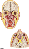 Paranasal Sinuses: Coronal and Transverse Sections