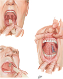 Oral Cavity: Clinical Examination