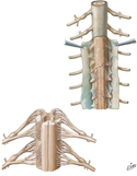 Spinal Meninges and Nerve Roots