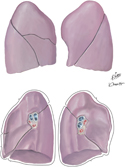 Lungs: Surface Features