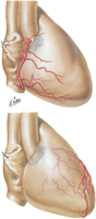 Coronary Arteries: Right Anterolateral Views With Arteriograms