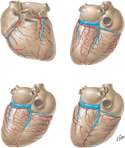 Coronary Arteries and Cardiac Veins: Variations