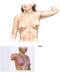 Thorax: Surface Anatomy