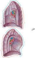Lungs: Medial Views