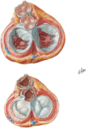 Valvular Complex of Heart