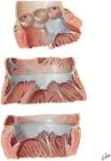 Heart Valves