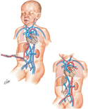 Prenatal and Postnatal Circulation