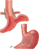 Gastroesophageal Junction