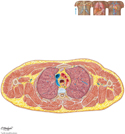 Thorax: Cross Section at T3/T4 Disc Level