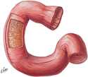 Duodenum: Layers of Wall