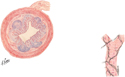Appendix and Gallbladder: CT and MRCP Images