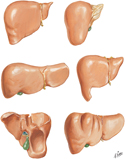 Liver: Variations in Form