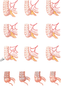 Cecum: Variations in Arterial Supply and Posterior Attachment
