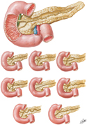 Pancreatic Duct: Variations