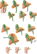 Cystic, Hepatic, and Pancreatic Ducts: Variations
