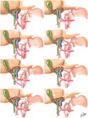 Hepatic Arteries: Variations