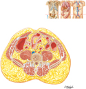 Abdomen: Cross Section at L5 Vertebral Level (Transtubercular Plane)