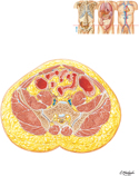Abdomen: Cross Section at S1 Vertebral Level (Interspinous Plane)