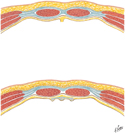 Rectus Sheath: Cross Section
