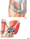 Inguinal Region: Dissections