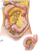 Mesocolons and Root of Mesentery