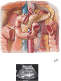 Duodenum In Situ