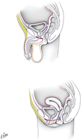 Fasciae of Pelvis and Perineum: Male and Female