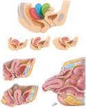 Uterus: Variations in Position and Prolapse